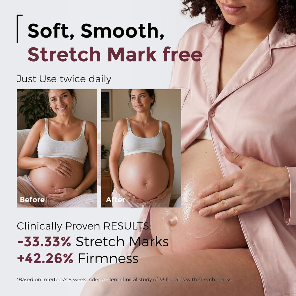 Maternity Comfort Bundle: Full Body U-Shaped Pregnancy Pillow & Hydrating Stretch Mark Cream - Total Body Support &